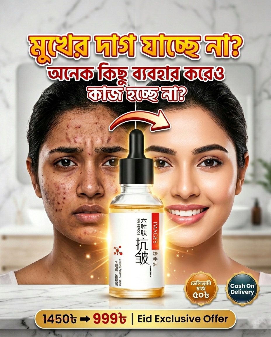 বিফর আফটার ১